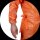 Medi-Inn CLASSIC Infektionsschutzkittel - orange - 139x139 cm - 100 Schutzkittel
